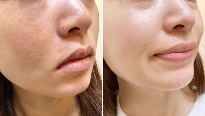 Tầm quan trọng của serum cấp ẩm và những thành phần "vàng" không thể bỏ qua 2 ea66ef5b524133245677d43d5f814a20
