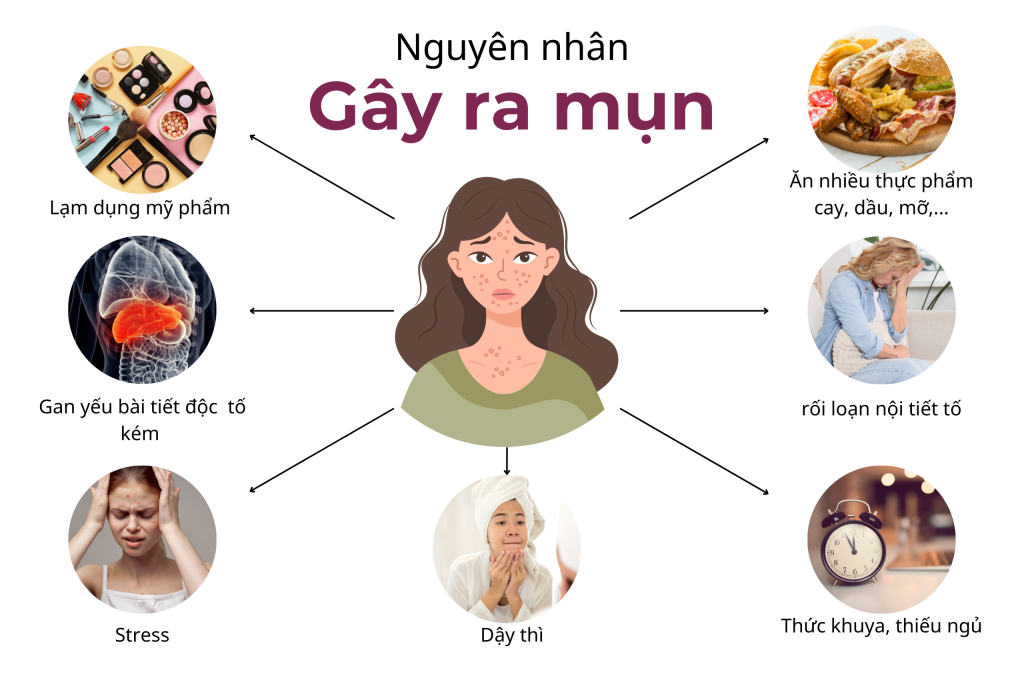 Mụn bọc không nhân có nguy hiểm không? Giải pháp chăm sóc và điều trị hiệu quả 1 nguyên nhân gây mụn bọc không nhân