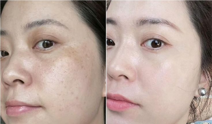 Tác dụng của melatonin