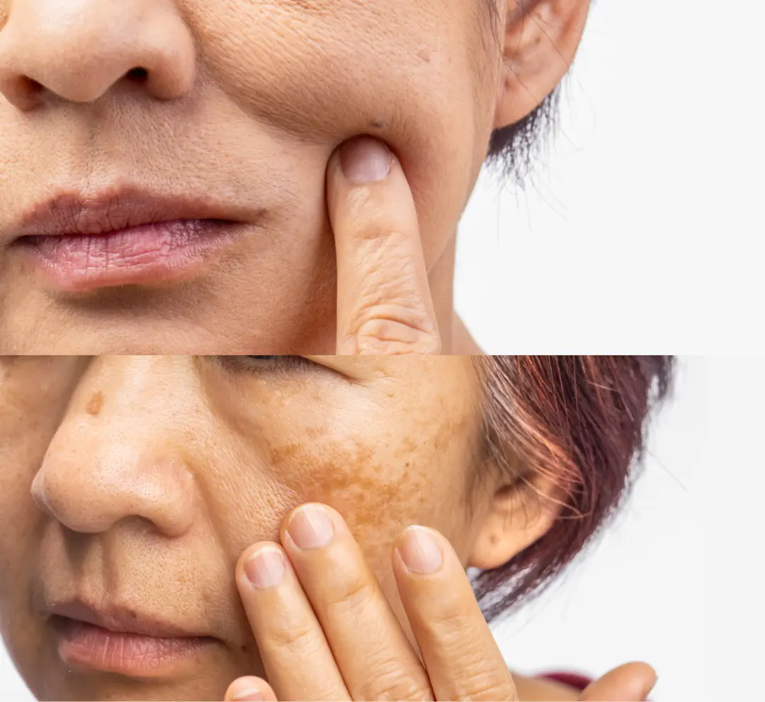 serum chống lão hóa cho tuổi 50